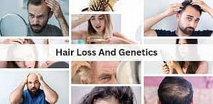 Genetics and Hair Loss