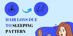 The Connection Between Sleep and Hair Loss