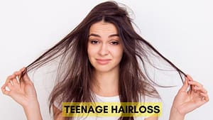 Hair Loss in Teens