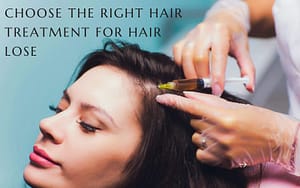 How to Choose the Right Hair Loss Treatment
